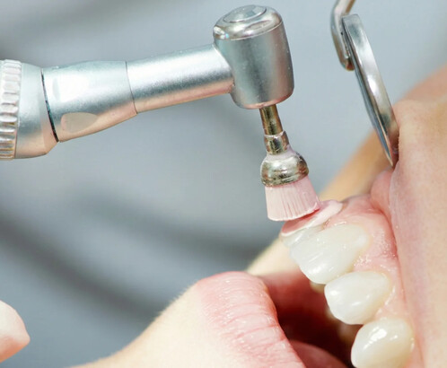 5 этапов проведения профессиональной гигиены