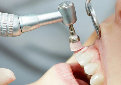 5 этапов проведения профессиональной гигиены