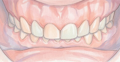 Антиэйдж и стоматология: как зубы влияют на молодость лица