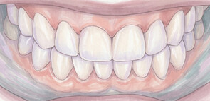 Антиэйдж и стоматология: как зубы влияют на молодость лица