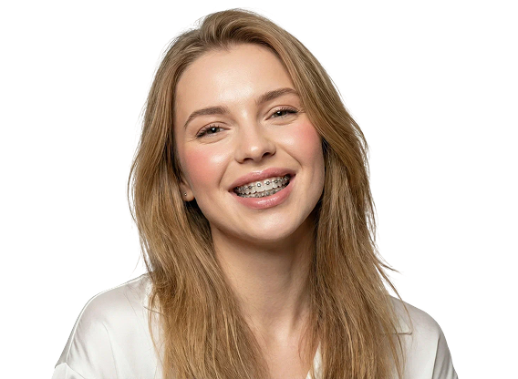 Брекеты Damon Q2 с установкой за 39 000 ₽