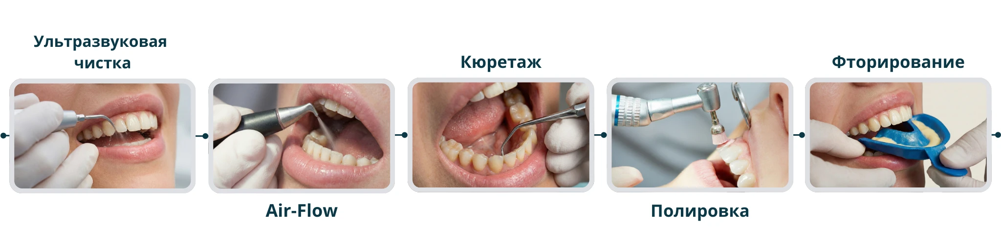 этапы профессиональной чистки зубов у стоматолога гигиениста