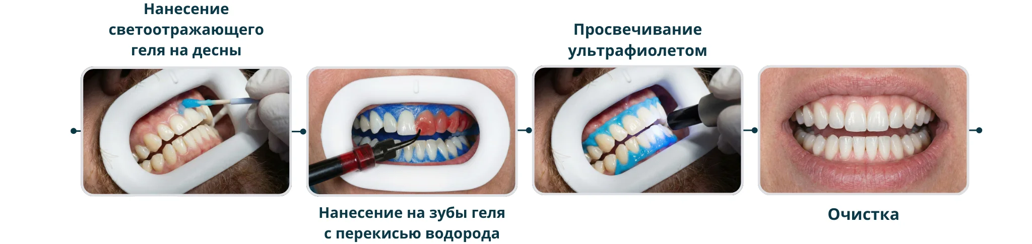 задачи отбеливания зубов у стоматолога