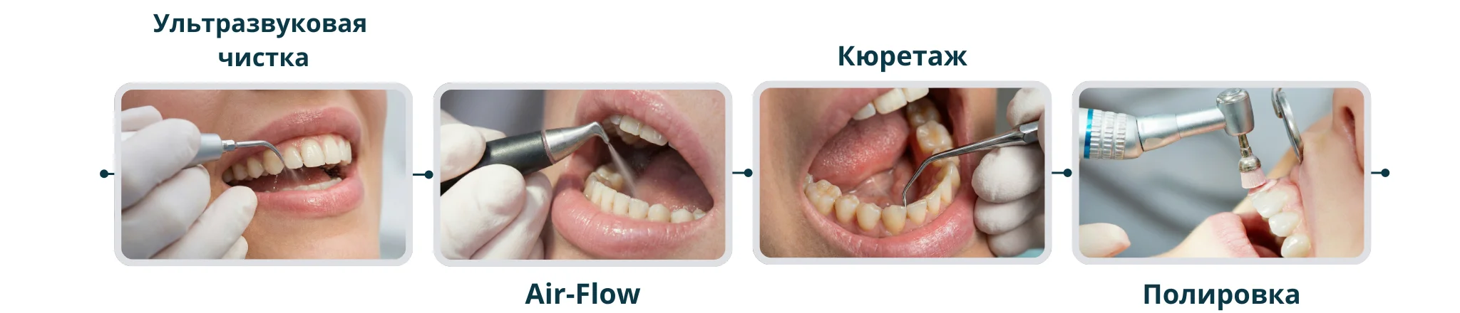 задачи профессиональной гигиены зубов