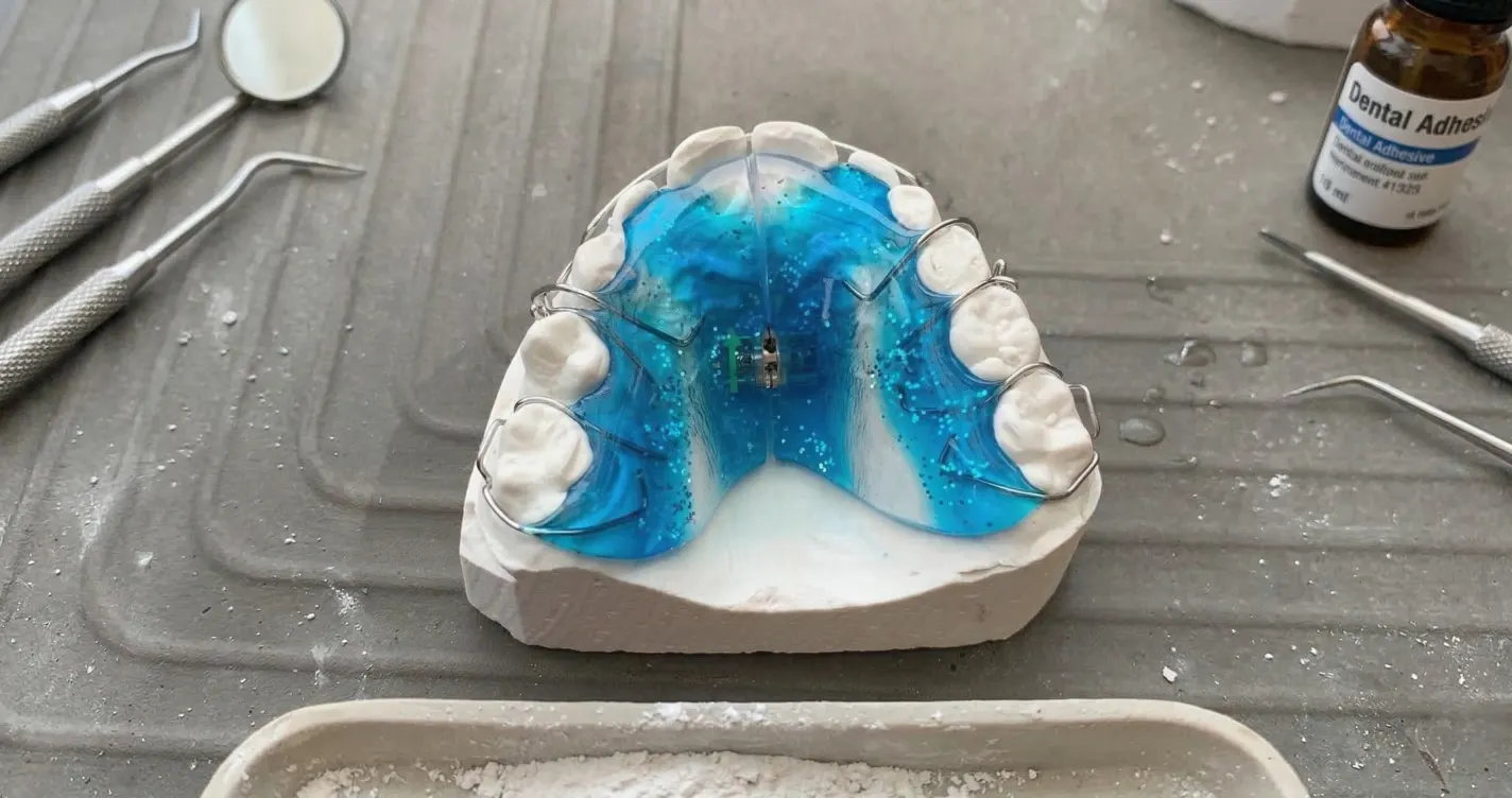 Съемные пластинки для выравнивания зубов для детей