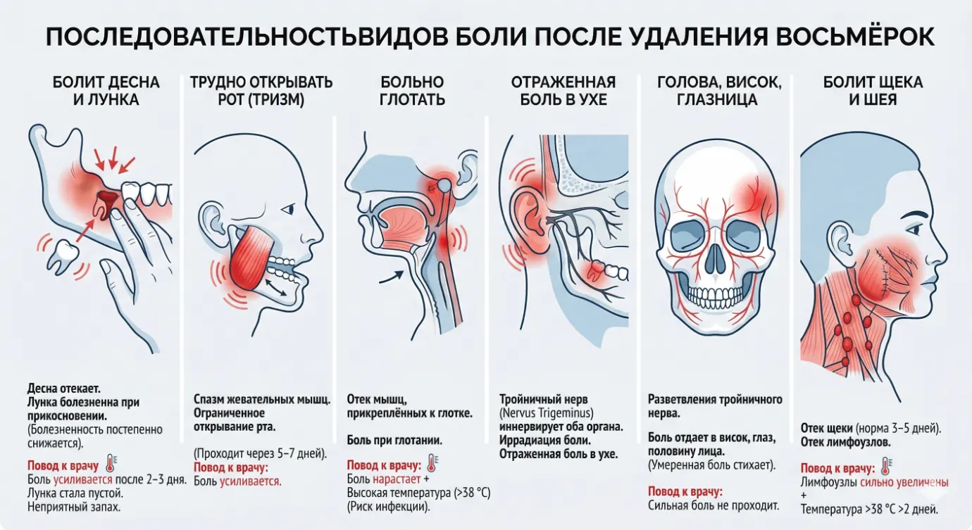 Виды боли после удаления восьмых зубов