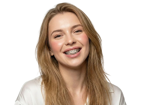 Брекеты Damon Q2 с установкой за 39 000 рублей