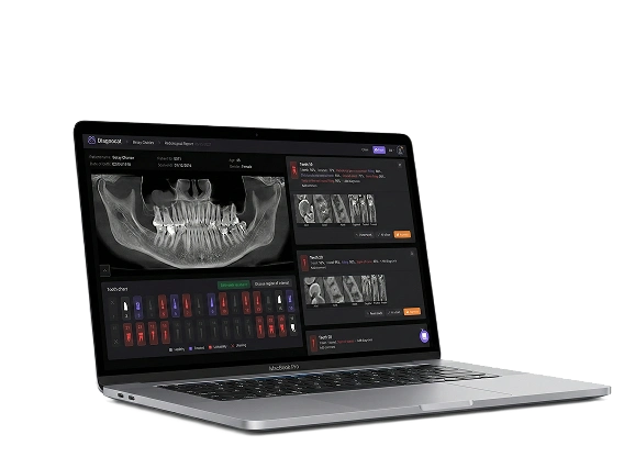 Welcome-пакет: профгигиена, КТ и ИИ-диагностика за 5 900 рублей